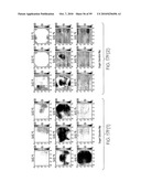 METHOD AND APPARATUS FOR MEDICAL IMAGING USING COMBINED NEAR-INFRARED OPTICAL TOMOGRAPHY, FLUORESCENT TOMOGRAPHY AND ULTRASOUND diagram and image