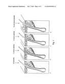 PROCESS FOR TREATMENT OF PSORIASIS diagram and image