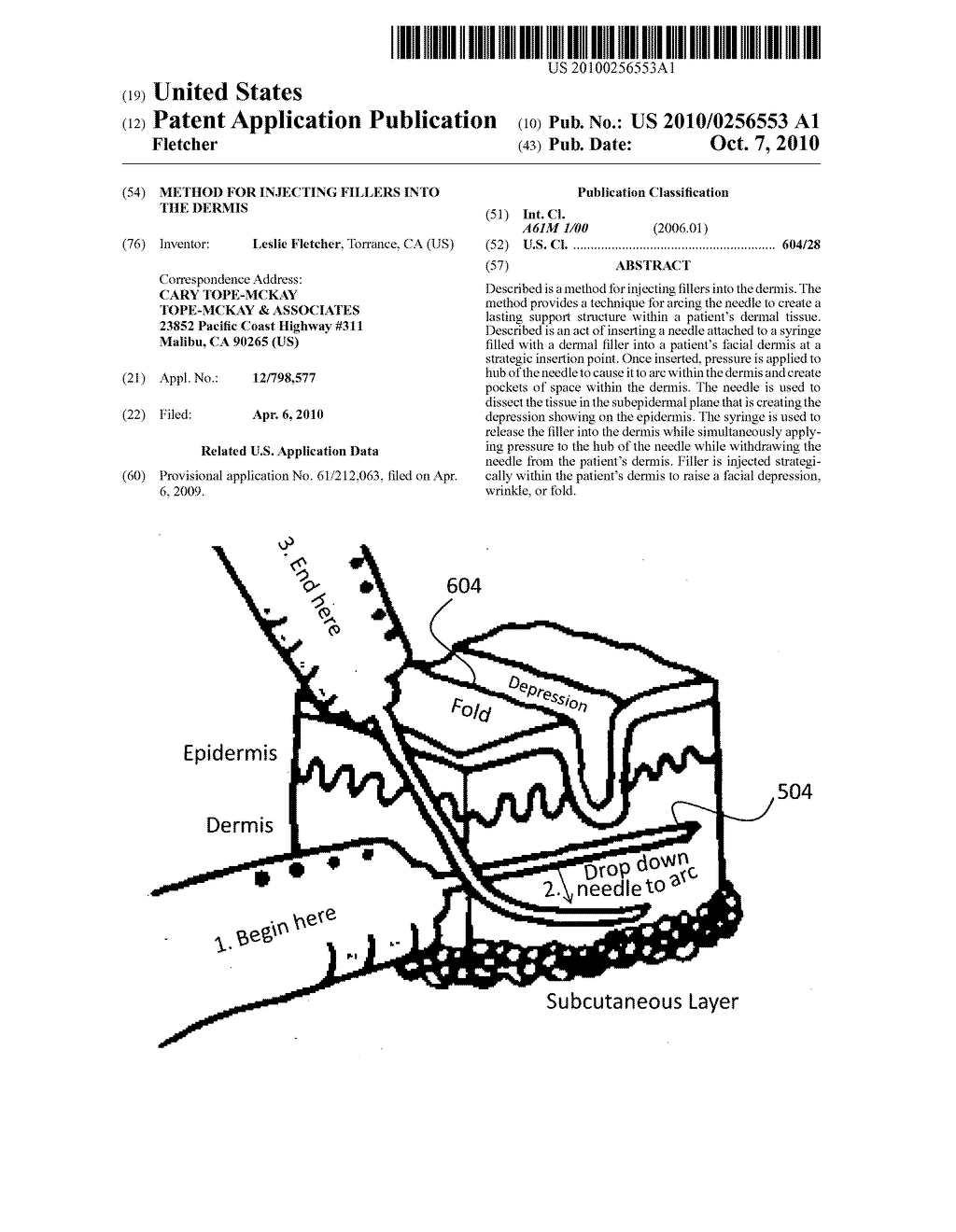 Method for injecting fillers into the dermis - diagram, schematic, and image 01