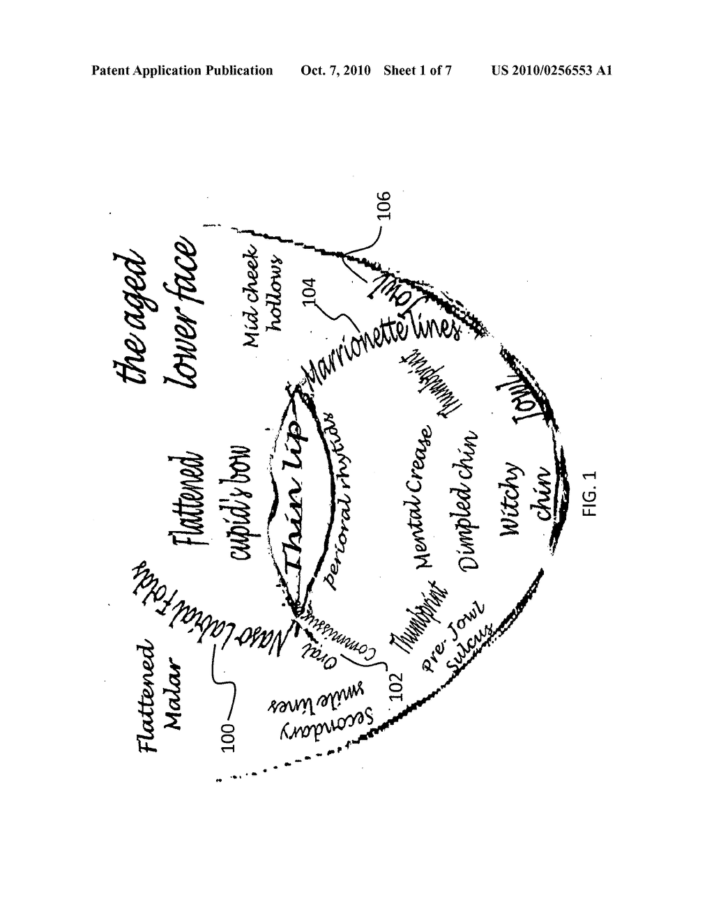 Method for injecting fillers into the dermis - diagram, schematic, and image 02