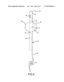 Method of Using a Partial-Length, Indwelling Prostatic Catheter Having a Coiled Inflation Tube as an Anchor diagram and image