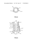 Method of Using a Partial-Length, Indwelling Prostatic Catheter Having a Coiled Inflation Tube as an Anchor diagram and image