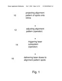 Patterned Laser Treatment diagram and image