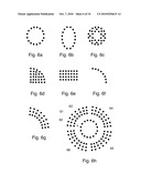 Patterned Laser Treatment diagram and image