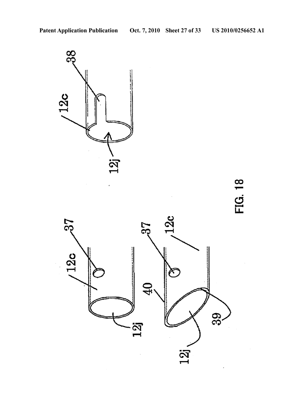 INSERTION DEVICE FOR INTRAOCULAR LENS - diagram, schematic, and image 28