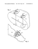 SUTURE CLIPS FOR SECURING SUTURES diagram and image