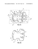 Intervertebral Implant diagram and image