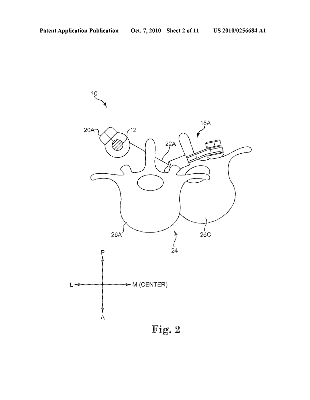 SEMI-CONSTRAINED ANCHORING SYSTEM - diagram, schematic, and image 03