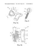 SEMI-CONSTRAINED ANCHORING SYSTEM diagram and image