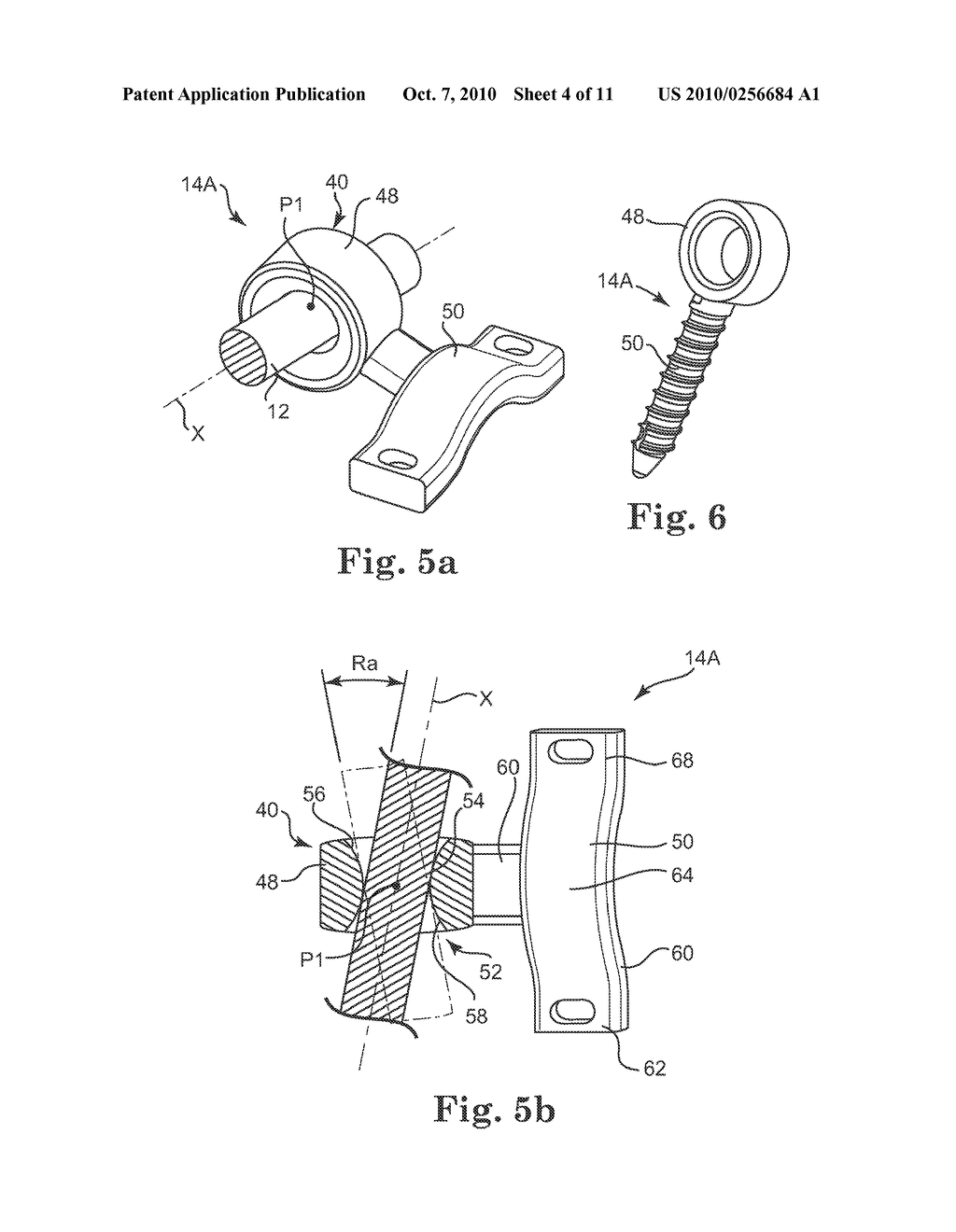 SEMI-CONSTRAINED ANCHORING SYSTEM - diagram, schematic, and image 05