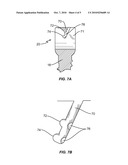 SLIDER LOCKING MECHANISM FOR PEDICLE SCREWS diagram and image