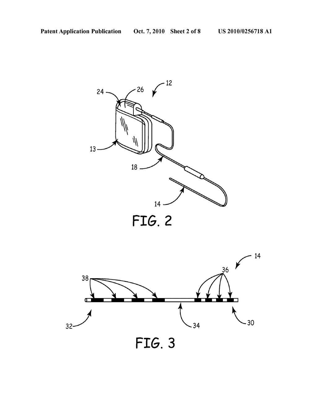 Wire Configuration and Method of Making for an Implantable Medical Apparatus - diagram, schematic, and image 03