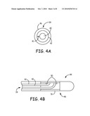 Wire Configuration and Method of Making for an Implantable Medical Apparatus diagram and image