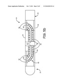 Wire Configuration and Method of Making for an Implantable Medical Apparatus diagram and image