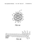 Wire Configuration and Method of Making for an Implantable Medical Apparatus diagram and image