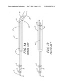 DEPLOYABLE MEDICAL LEAD FIXATION SYSTEM AND METHOD diagram and image