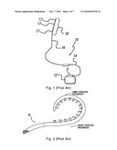 IMPLANTABLE OR INSERTABLE MEDICAL DEVICES diagram and image