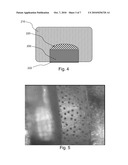 IMPLANTABLE OR INSERTABLE MEDICAL DEVICES diagram and image