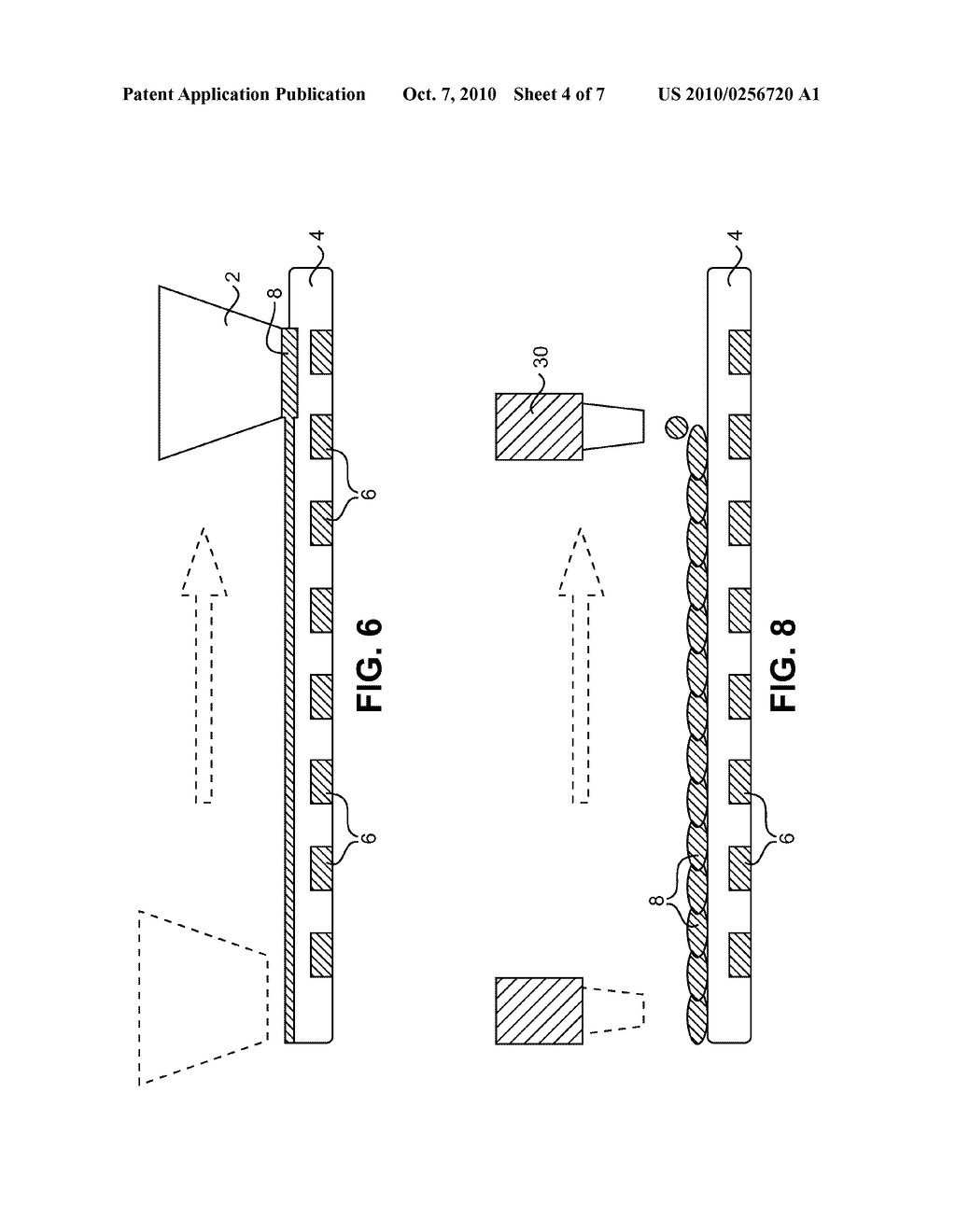 IMPLANTABLE OR INSERTABLE MEDICAL DEVICES - diagram, schematic, and image 05