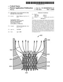 Prosthetic Valve With Device for Restricting Expansion diagram and image