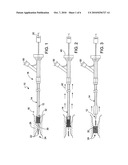 CATHETER diagram and image