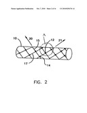 Endoprostheses and methods of manufacture diagram and image