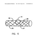 Endoprostheses and methods of manufacture diagram and image