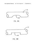 Endoprostheses and methods of manufacture diagram and image