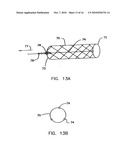 Endoprostheses and methods of manufacture diagram and image