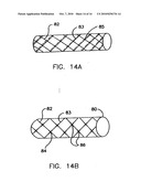 Endoprostheses and methods of manufacture diagram and image