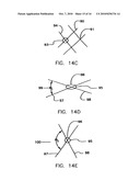 Endoprostheses and methods of manufacture diagram and image