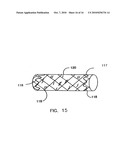 Endoprostheses and methods of manufacture diagram and image