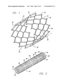 SINGLE-PIECE ENDOPROSTHESIS WITH HIGH EXPANSION RATIOS AND ATRAUMATIC ENDS diagram and image