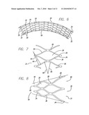 SINGLE-PIECE ENDOPROSTHESIS WITH HIGH EXPANSION RATIOS AND ATRAUMATIC ENDS diagram and image