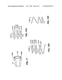 IMPLANTABLE TEMPORARY FLOW RESTRICTOR DEVICE diagram and image