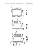 IMPLANTABLE TEMPORARY FLOW RESTRICTOR DEVICE diagram and image