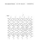 STENT diagram and image