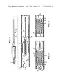 Locking Polymer Stents diagram and image