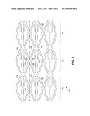 Locking Polymer Stents diagram and image