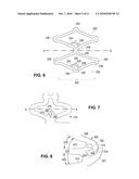 Locking Polymer Stents diagram and image