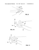 Locking Polymer Stents diagram and image