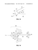 Locking Polymer Stents diagram and image