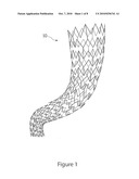 MODULAR STENT ASSEMBLY diagram and image