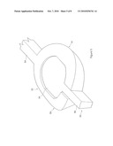 MODULAR STENT ASSEMBLY diagram and image