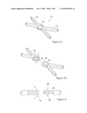 MODULAR STENT ASSEMBLY diagram and image