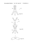 MODULAR STENT ASSEMBLY diagram and image