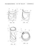 Prosthetic Heart Valves, Scaffolding Structures, and Systems and Methods for Implantation of Same diagram and image