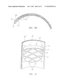 Prosthetic Heart Valves, Scaffolding Structures, and Systems and Methods for Implantation of Same diagram and image