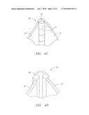 Prosthetic Heart Valves, Scaffolding Structures, and Systems and Methods for Implantation of Same diagram and image