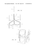 Prosthetic Heart Valves, Scaffolding Structures, and Systems and Methods for Implantation of Same diagram and image